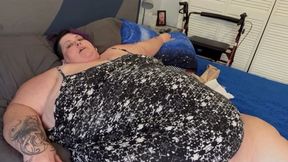 Medical Bedrest for Complications of Obesity SD
