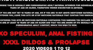 Anal Queen Hotkinkyjo Takes Extreme Insertions and Prolapse Stretching