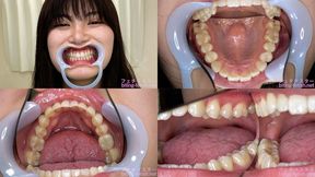 Nonoka Akari - Watching Inside mouth of Japanese cute girl bite-272-1 - 1080p