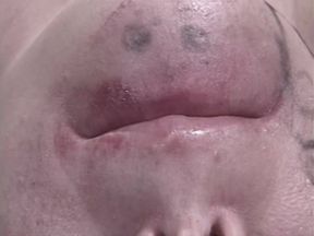 120 Oral Pop Shots
