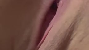 Hemorrhoid Queef