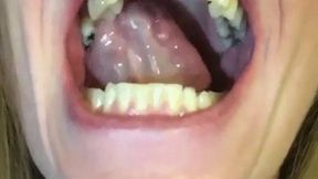 MOUTH WIDE OPEN