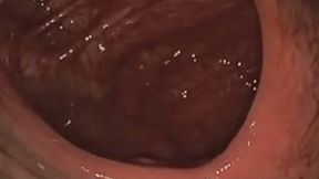 Yummy Tiny Human Snack