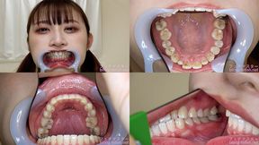 Misono - Watching Inside mouth of Japanese cute girl bite-267-1 - MOV