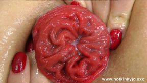 Deep anal&#x1F44C; penetration with massive dongs causing prolapse & ejaculation