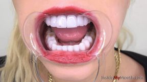 Inside My Mouth - Barbie Sins - Mouth retractor time! (FULLHD quality)