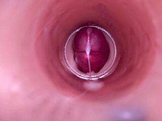 Female Insemination - Internal Camera Captures Deep Male Ejaculation