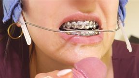 Braces HEADGEAR FUN & CUM