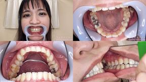 Rin - Watching Inside mouth of Japanese cute girl bite-239-1 - wmv