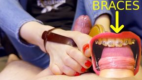 Braces HERBST & Sandal Shoejob