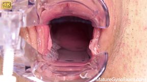 Shy Mature Woman's Cervix Explored!