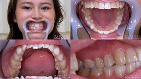 Erika Kononoba - Watching Inside mouth of Japanese cute girl - 1080p