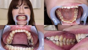 Sara - Watching Inside mouth of Japanese cute girl bite-222-1 - 1080p
