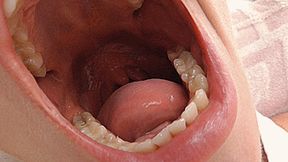 Blondie loves to yawn! MP4