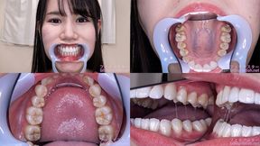Miho - Watching Inside mouth of Japanese cute girl bite-227-1 - 1080p