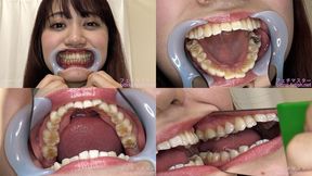 Yukino - Watching Inside mouth of Japanese cute girl bite-261-1 - MOV