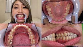 Kurumi - Watching Inside mouth of Japanese cute girl bite-184-1 - 1080p