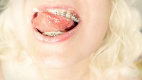 BRACES fetish - ASMR clip of eating MUKBANG...