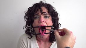gag reflex fetish - covid uvula swab
