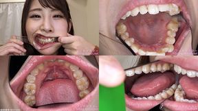 Mai - Watching Inside mouth of Japanese cute girl bite-244-1 - wmv