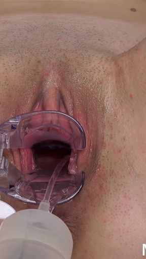 Cervix of Shy MILF Revealed!