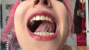 my dental history