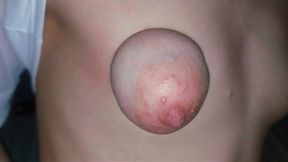 Expanding 18-Year-Old Mammaries
