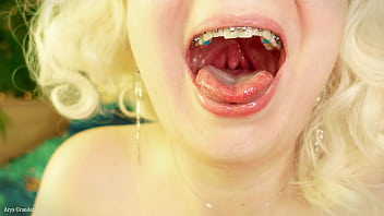 brace face review video close up (Arya Grander)