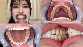 Miyu - Watching Inside mouth of Japanese cute girl bite-257-1 - 1080p