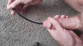11 Inch Deep Urethra Insertion into Prostate, Bladder Too Big