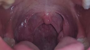 Storms Mouth