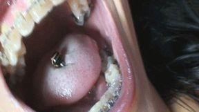 Wenona "Tongue & Braces"