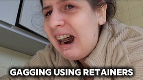 Can’t Stop Gagging With My Retainers In – Talking & Drooling in the Kitchen