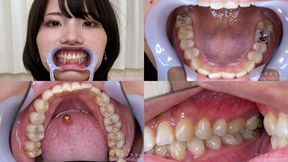Haruna Kawai - Watching Inside mouth of Japanese cute girl