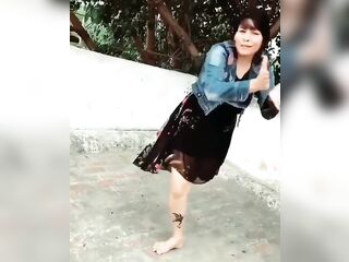 amputee