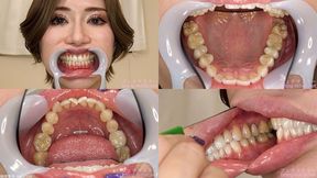 ERINA - Watching Inside mouth of Japanese cute girl bite-255-1 - 1080p