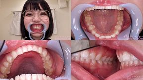 Nenne - Watching Inside mouth of Japanese cute girl bite-199-1 - 1080p