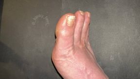Foot Filing and Dust Collection
