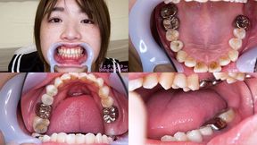 Mai Kagari - Watching Inside mouth of Japanese cute girl - MOV