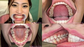 Ena - Watching Inside mouth of Japanese attractive girl BITE-39-1 - 1080p wmv
