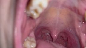 flashlight on my uvula 2