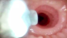 Up close scrutiny of Lopuza93's ravaged rectum and puckered maw via invasive scope peek
