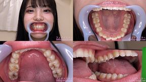 Kyoka - Watching Inside mouth of Japanese cute girl bite-228-1 - wmv