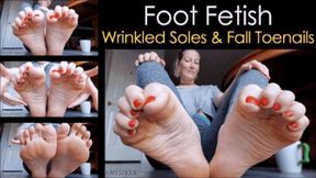 Foot Fetish: Wrinkled Soles and Fall Toenails - mp4