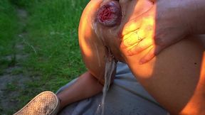 extreme anal outdoor
