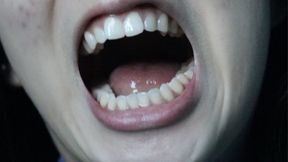 Aurora Covers Her Teeth In Her Saliva