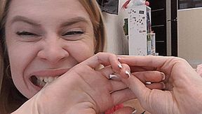Biting hands and fingers with big teeth! MP4