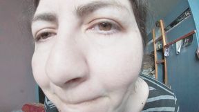 Wet, allergic nose