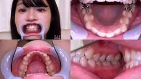 Wakana Yamori - Watching Inside mouth of Japanese cute girl - MOV 1080p