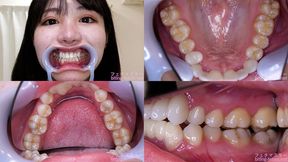 Hikage Hinata - Watching Inside mouth of Japanese cute girl - 1080p